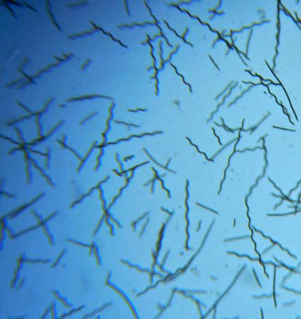 spiruline algue bleue : vue au microscope